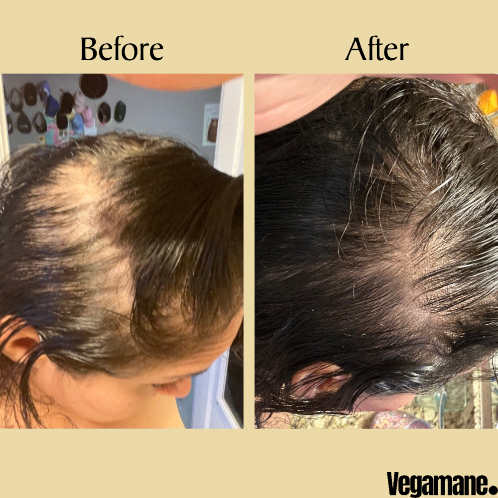 Vegamane™ Natural Hair Growth Oil